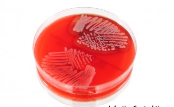 Staphylococcus Aureus