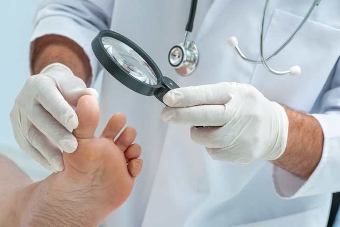 Prevent Diabetic Foot Infections to Cut the Risk of Amputation