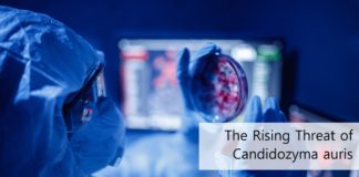 The Rising Threat of Candidozyma auris
